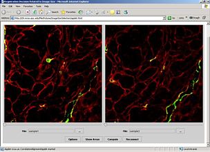 CLSM Alignment tool sample image small: Fluorescent confocal laser scanning microscopy (CLSM). Registration and Cross Section Alignment Tool.