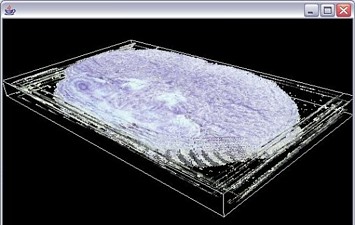 3D MRI Volume - integrated multiple cross-sections
