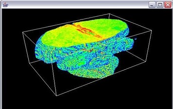 3D MRI Volume - Pseudocolour