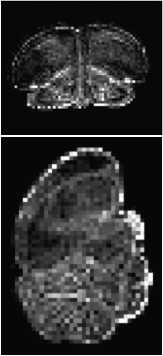 Fractional anisotropy (FA) MRI images